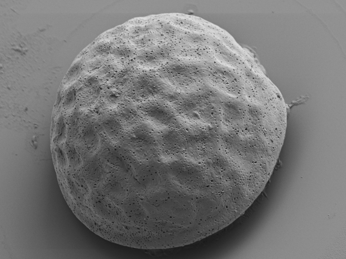Arcella gibbosa SEM Electron Microscopy