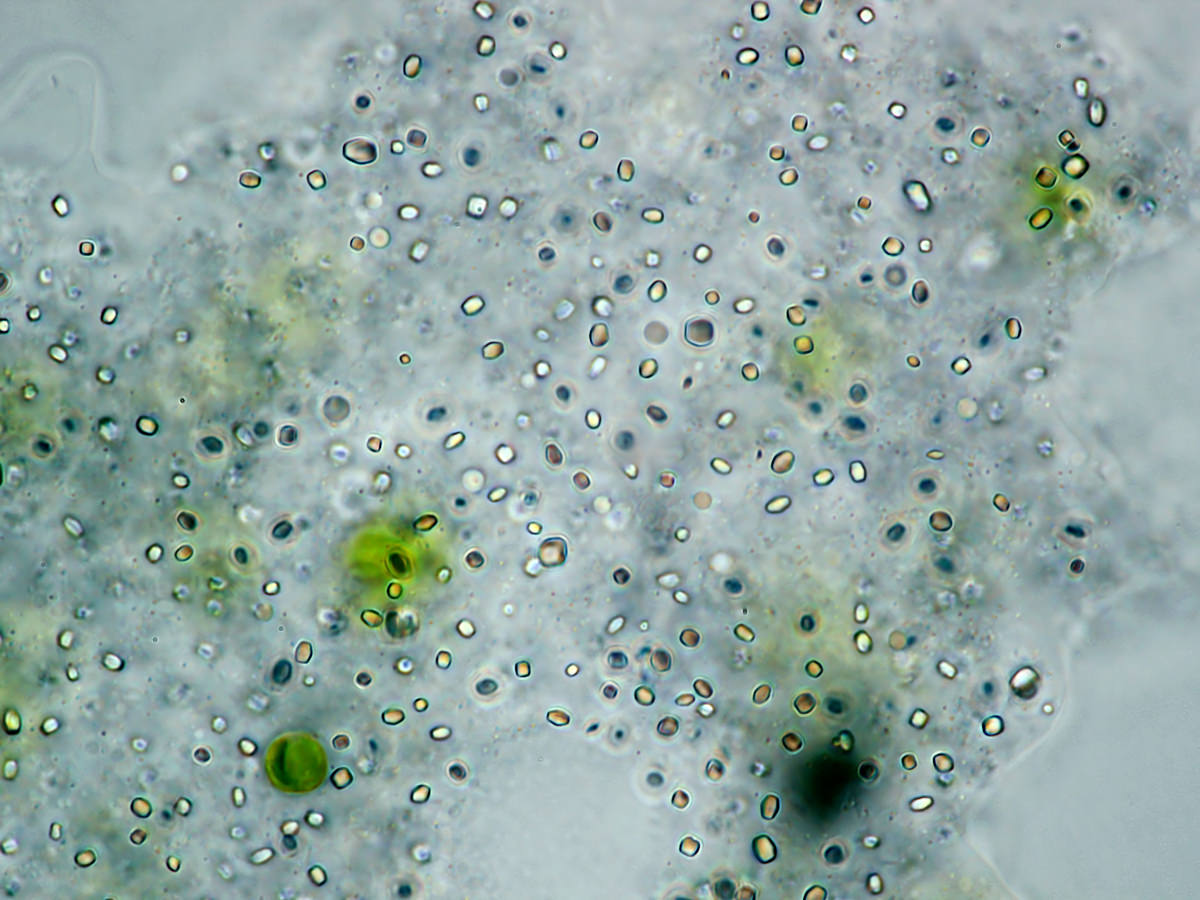 Amoeba proteus crystals