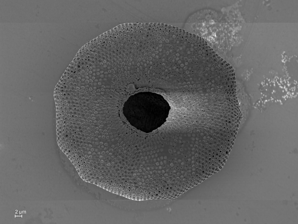 Arcella aperture SEM Electron Microscopy
