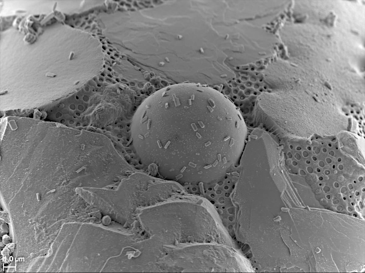 Difflugia Organic cement SEM Electron Microscope