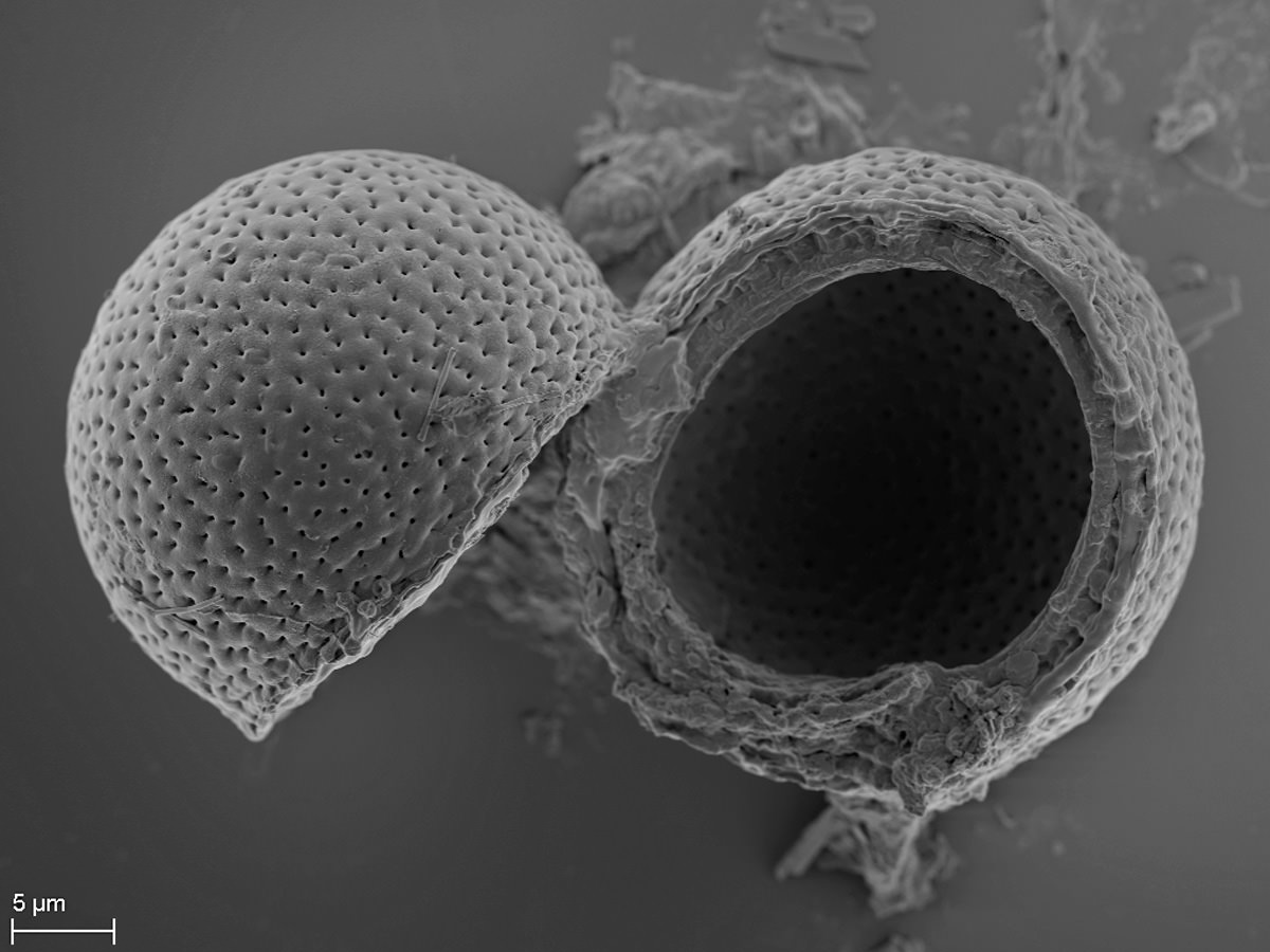 Pyxidicula patens SEM Electron Microsopy